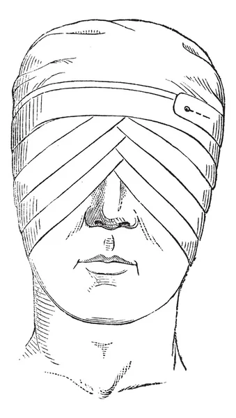 Фиг. 176. Очкарик или повязка для глаз пересекает два шара, винтажный — стоковый вектор