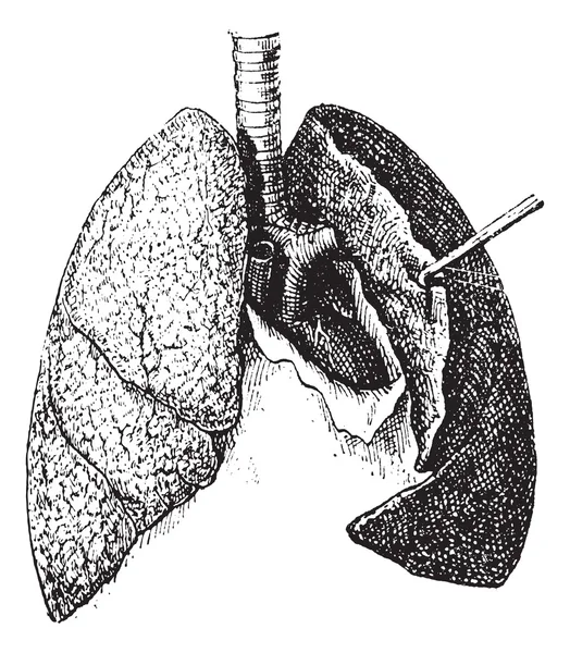Incisione vintage sui polmoni umani — Vettoriale Stock