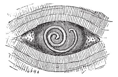 Pork Roundworm or Trichinella spiralis, vintage engraving clipart