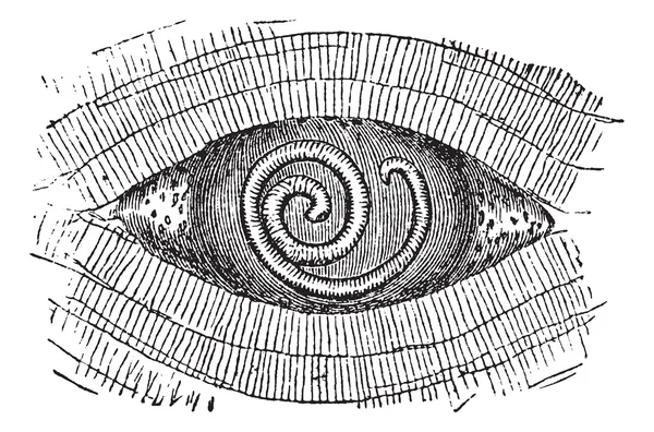 Ver rond de porc ou Trichinella spiralis, gravure vintage — Image vectorielle
