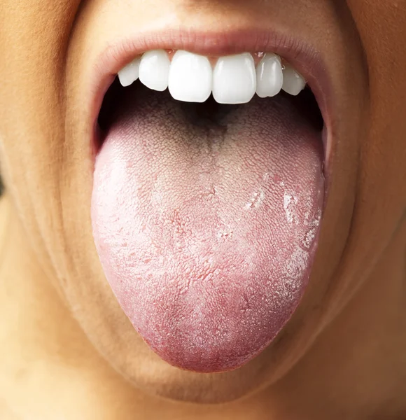 Frau zeigt die Zunge, Nahaufnahme — Stockfoto