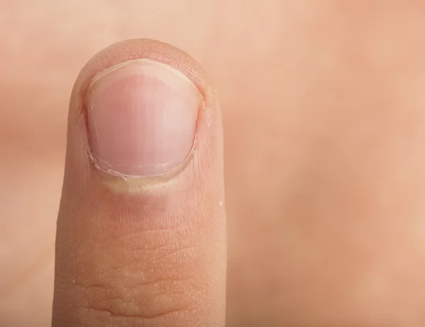 Палець — стокове фото