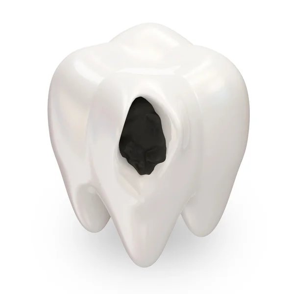 Dente sobre fundo branco — Fotografia de Stock
