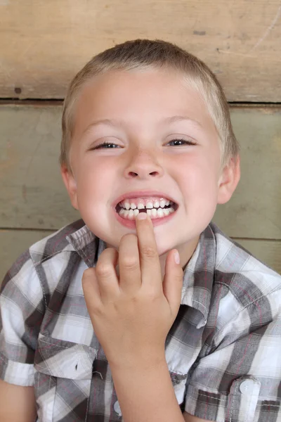 Chybějící zub — Stock fotografie