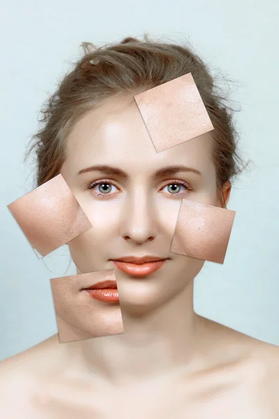 Prima e dopo della pelle della donna — Foto Stock