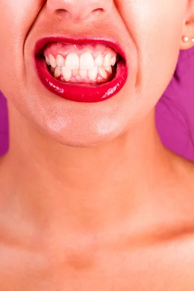 Teeth cringe — Stock Photo, Image