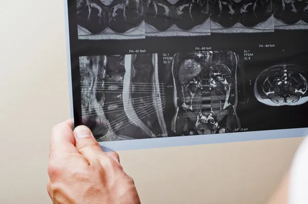 stock image MRI of a patient