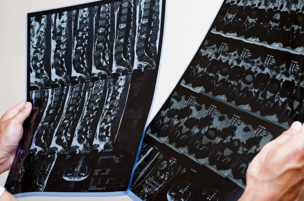 MRI pacjenta — Zdjęcie stockowe