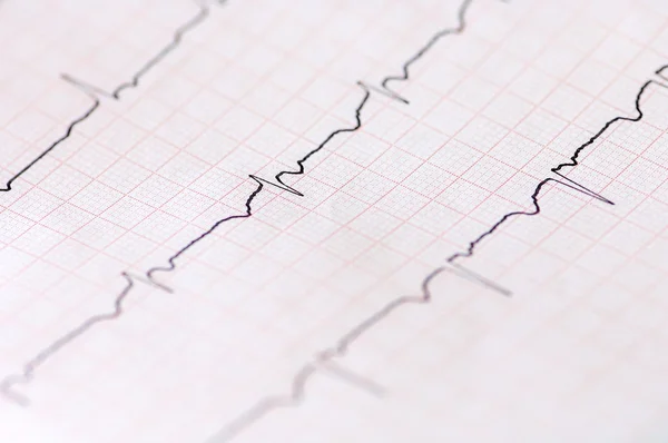 stock image Electrocardiogram