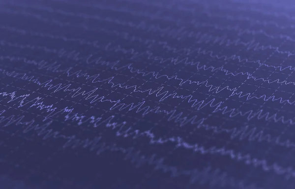 Волновые колебания, мозговые волны на энцефалограмме — стоковое фото