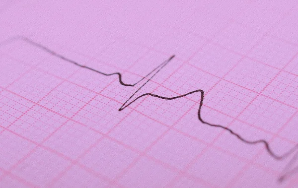 EKG graf, elektrokardiogram ekg — Stock fotografie