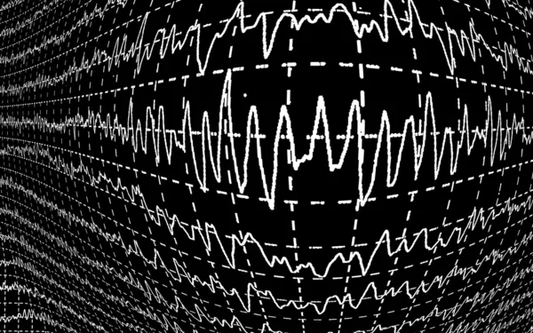 ЭЭГ волны мозга изолированы на черном фоне — стоковое фото