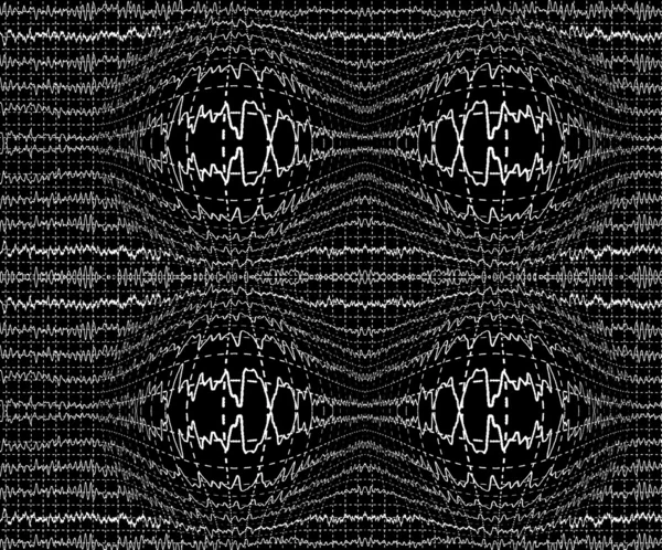 Хвилі мозку на енцефалограмі ЕЕГ — стокове фото