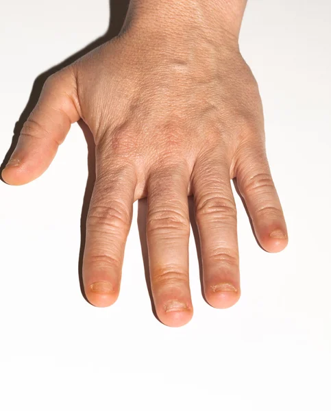 Рука с ногтями — стоковое фото