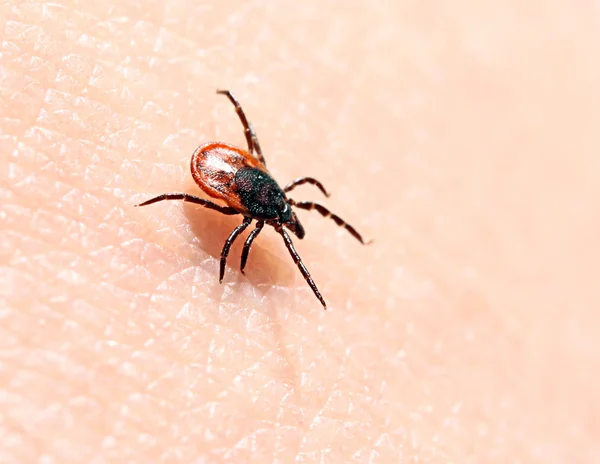 Ticks ​​on human skin. — Stock Photo, Image