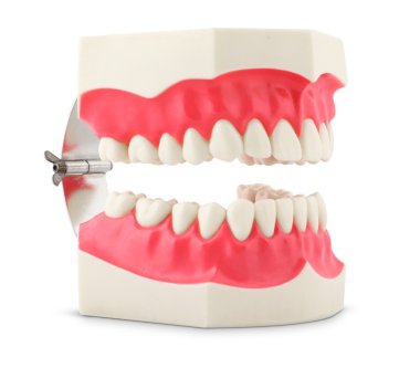 Dental model of teeth clipart