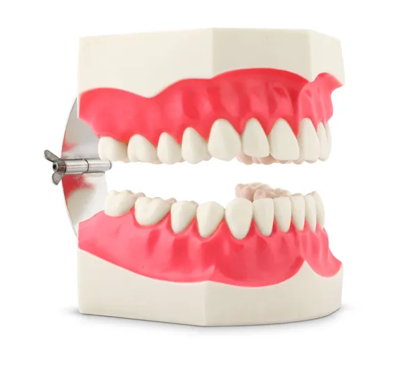 Modelo dental de dientes —  Fotos de Stock
