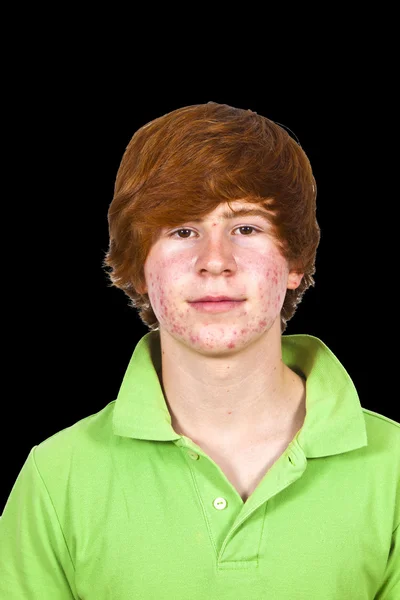 Aantrekkelijke jongen in puberteit met rood haar — Stockfoto