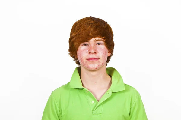Atractivo chico en la pubertad con el pelo rojo —  Fotos de Stock