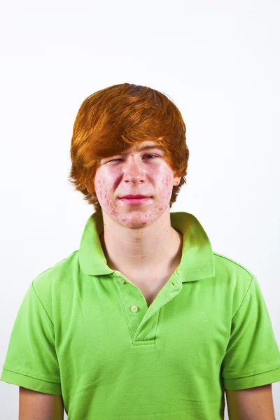 Menino atraente na puberdade com cabelo vermelho — Fotografia de Stock