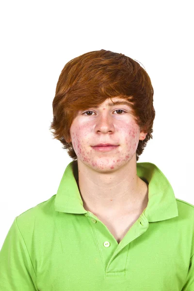 Attractive boy in puberty with red hair Royalty Free Stock Photos