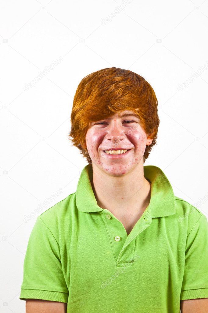 Attractive boy in puberty with red hair