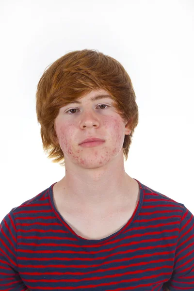 Attraktiva pojke i puberteten med rött hår — Stockfoto