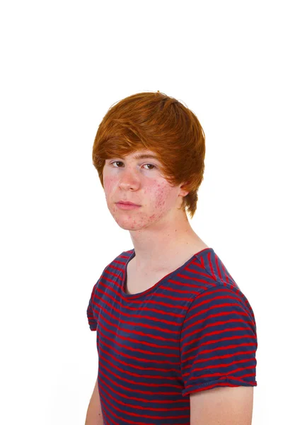 Attractive boy in puberty with red hair — Stock Photo, Image