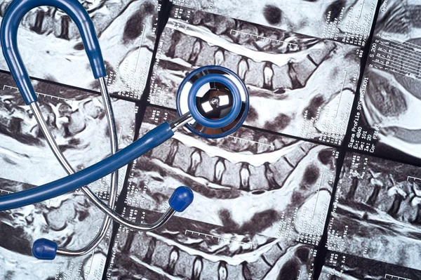 MRI üzerinde stethosope — Stok fotoğraf