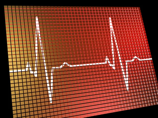 Monitor de Frequência Cardíaca mostrando Saúde Cardíaca e Coronariana — Fotografia de Stock