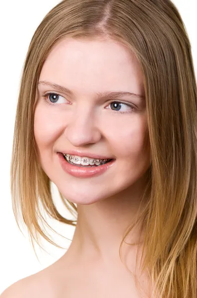 stock image Beautiful young woman with brackets on teeth