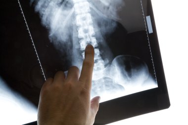 x-ray görüntü