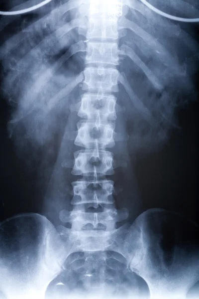 X-ray kép — Stock Fotó