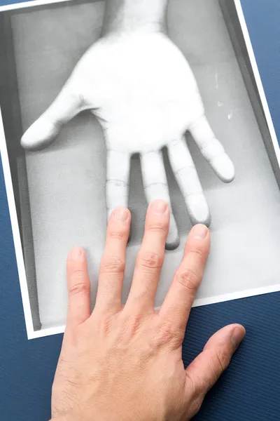Fotokopie der Hand — Stockfoto