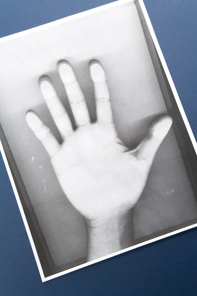 Φωτοτυπία του χεριού — Φωτογραφία Αρχείου