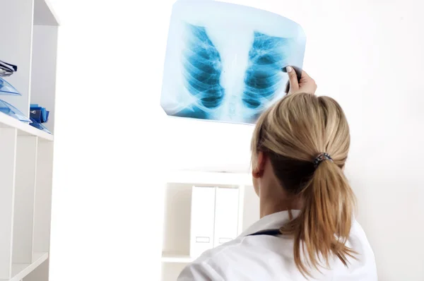 Kobieta lekarz patrząc na zdjęcia rentgenowskie — Zdjęcie stockowe
