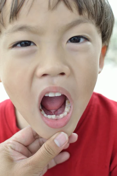 最初の歯 — ストック写真