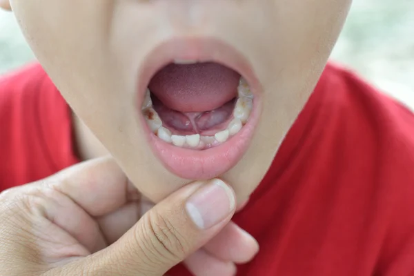 첫 번째 치아 — 스톡 사진