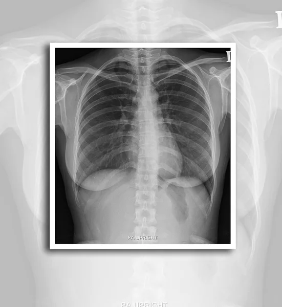 Película de rayos X — Foto de Stock