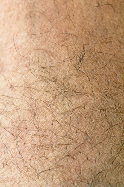 Ανθρώπινο δέρμα με σκέλη των μαλλιών από κοντά — Φωτογραφία Αρχείου