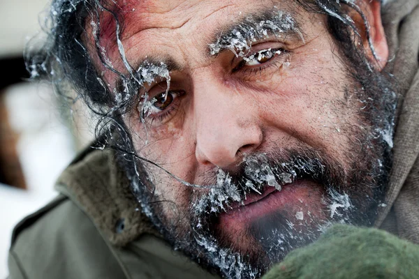 Obdachlose Winter gefroren Gesicht — Stockfoto