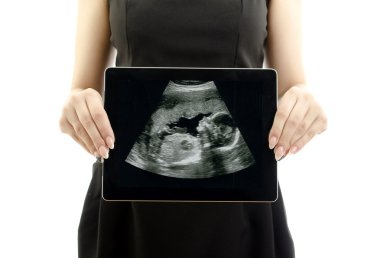 Woman holding tablet pc. Concept: Ultrasound image of baby in mother's clipart