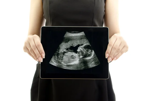 Женщина держит планшетный компьютер. Концепция: Ультразвуковое изображение ребенка в материнской — стоковое фото