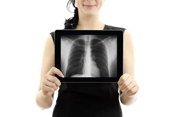 タブレット pc を保持している女性。かみ合い: 肺の x 線。白で隔離されます。. — ストック写真