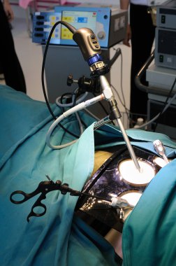 Minimally invasive surgery clipart