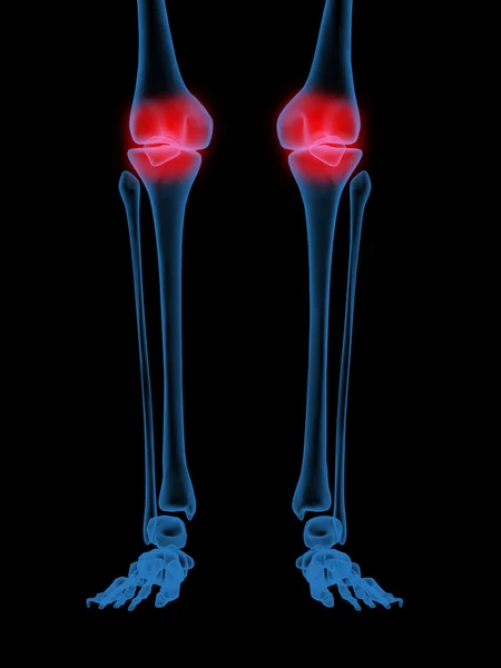 무릎 관절 — 스톡 사진