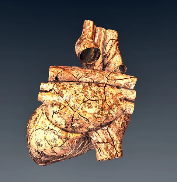 Modello di cuore umano rovinato — Foto Stock