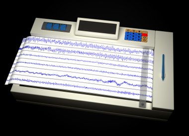 Encephalogram