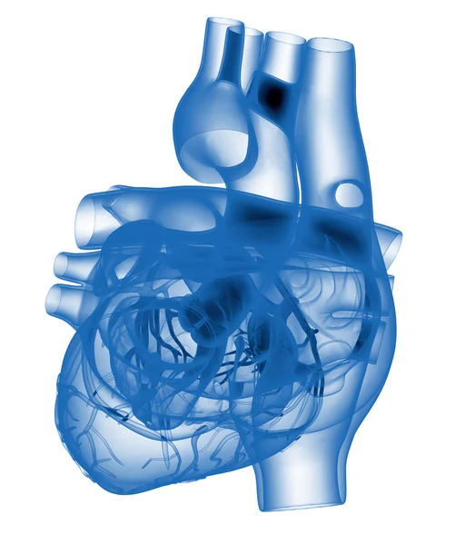 Model van kunstmatige menselijk hart - geröntgend — Stockfoto