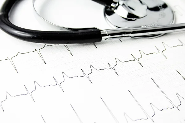 Cardiogram with stethoscope — Stock Photo, Image